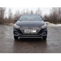 Решетка радиатора Hundai Solaris 2 верхняя